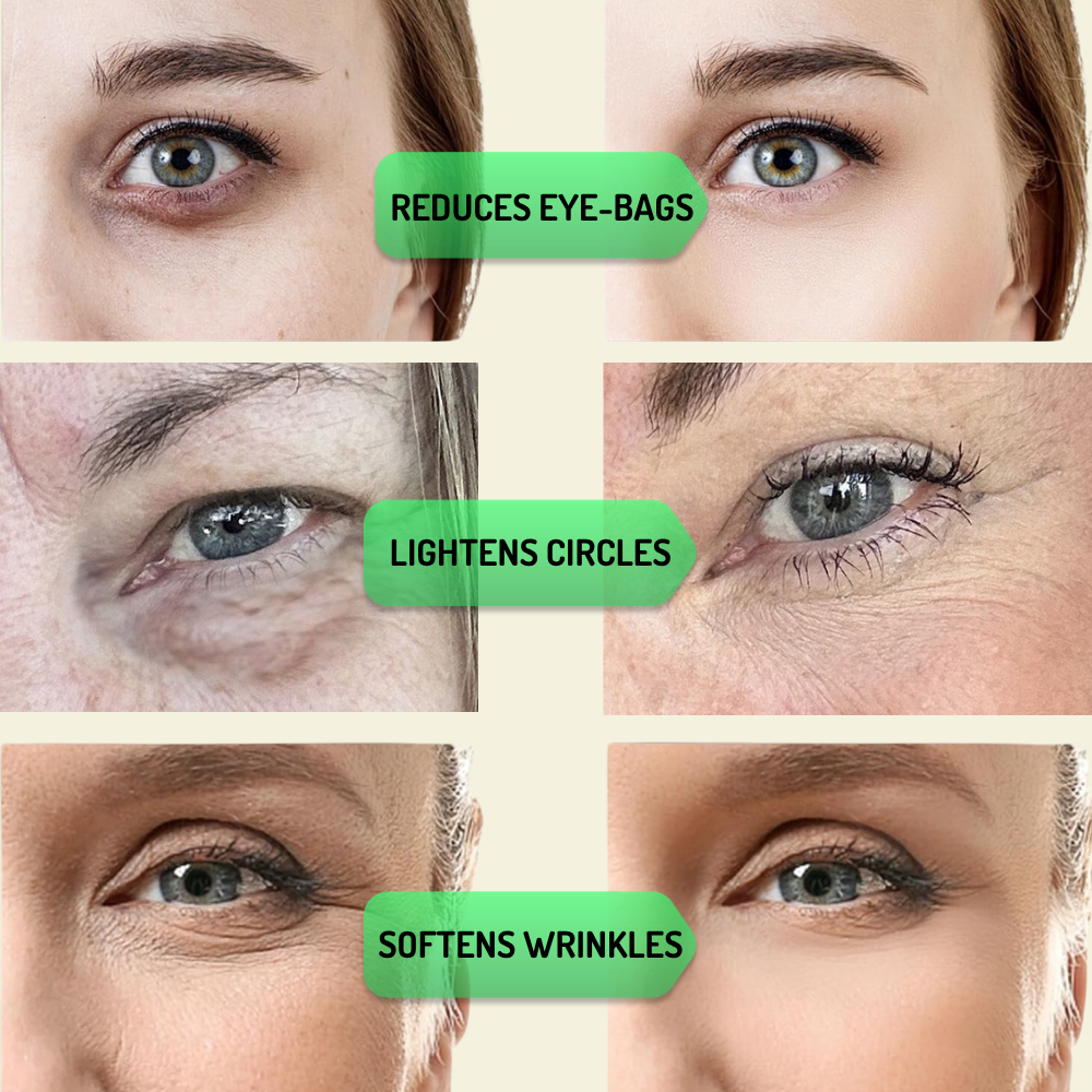 Under-Eye Radiance Frame – Targets Puffiness & Tired Eyes