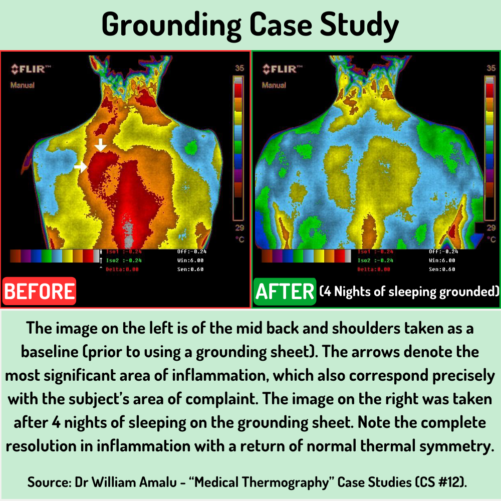 11 Grounding Case Study Back Pain2