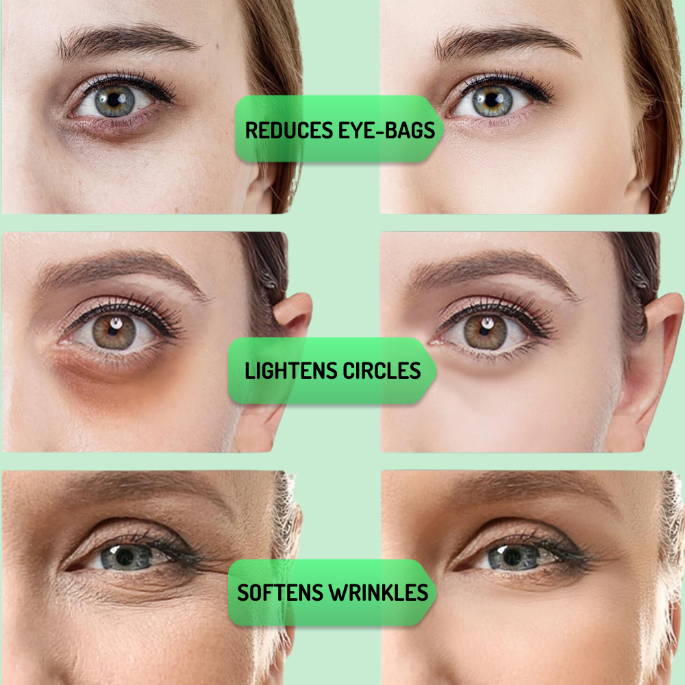 Under-Eye Radiance Frame